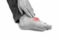 Gout Can Produce Extreme Pain