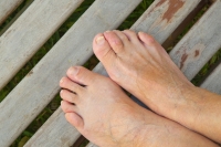 Treatment for Flexible and Rigid Hammertoes