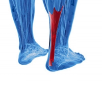 Symptoms of an Achilles Tendon Injury