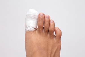 How Do I Know if I Broke My Toe?