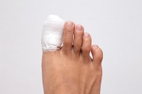 How Do I Know if I Broke My Toe?