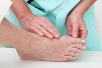 Causes and Symptoms of Bunions