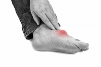 Who Is at Risk for Gout?