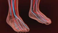 Causes of Poor Circulation